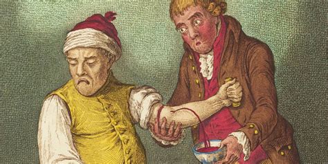 Bloodletting and the Spread of Disease: Lessons from the Past